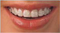 Ortodoncia, salud y estética