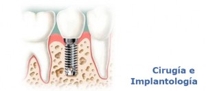 Cirugía e implantología