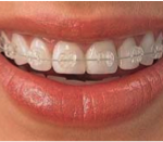 Ortodoncia, salud y estética