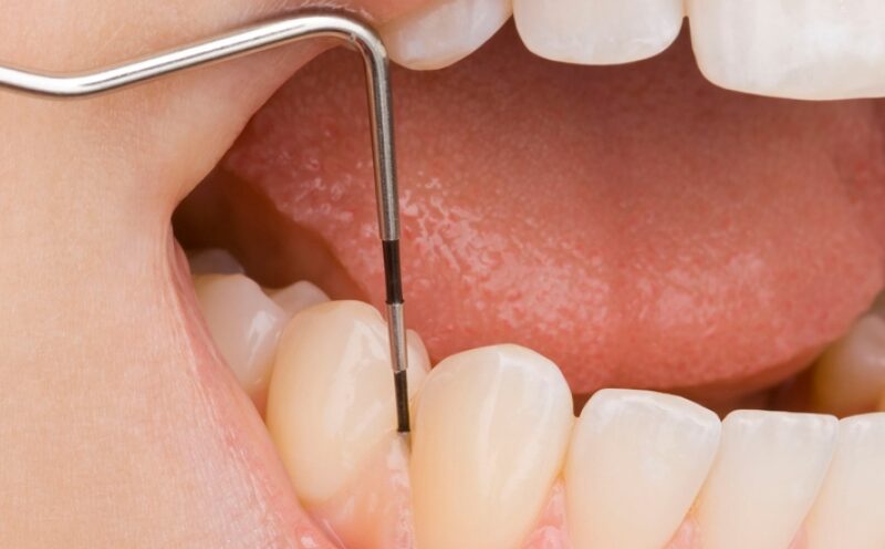 7 consejos de tu dentista para el verano