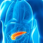 Las enfermedades bucales incrementan el riesgo de padecer cáncer de páncreas