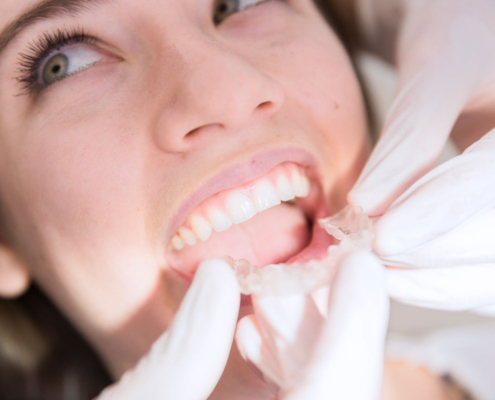 5 motivos para ponerse ortodoncia