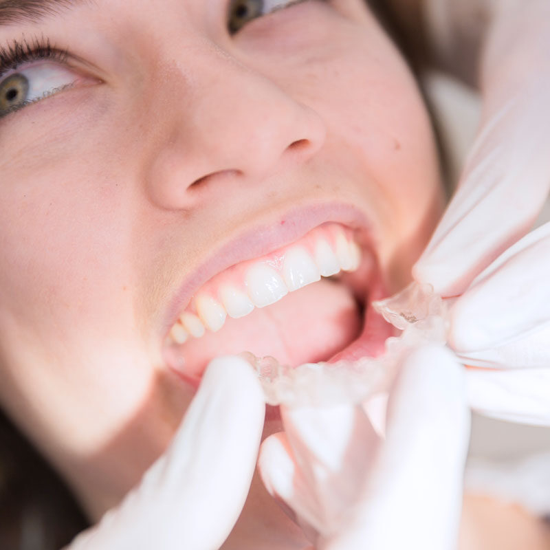 5 motivos para ponerse ortodoncia