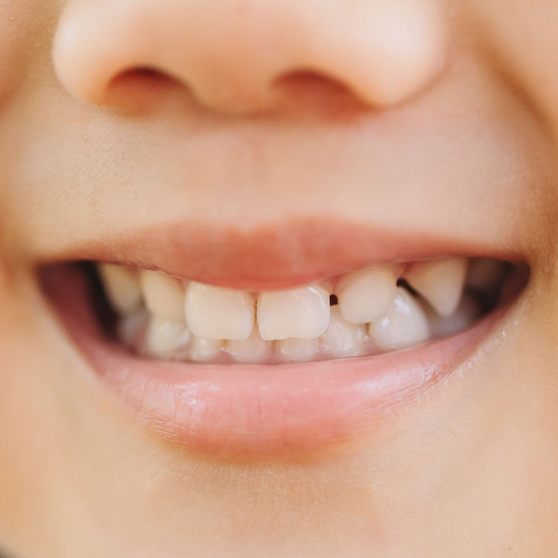 6 motivos para cuidar los dientes de leche