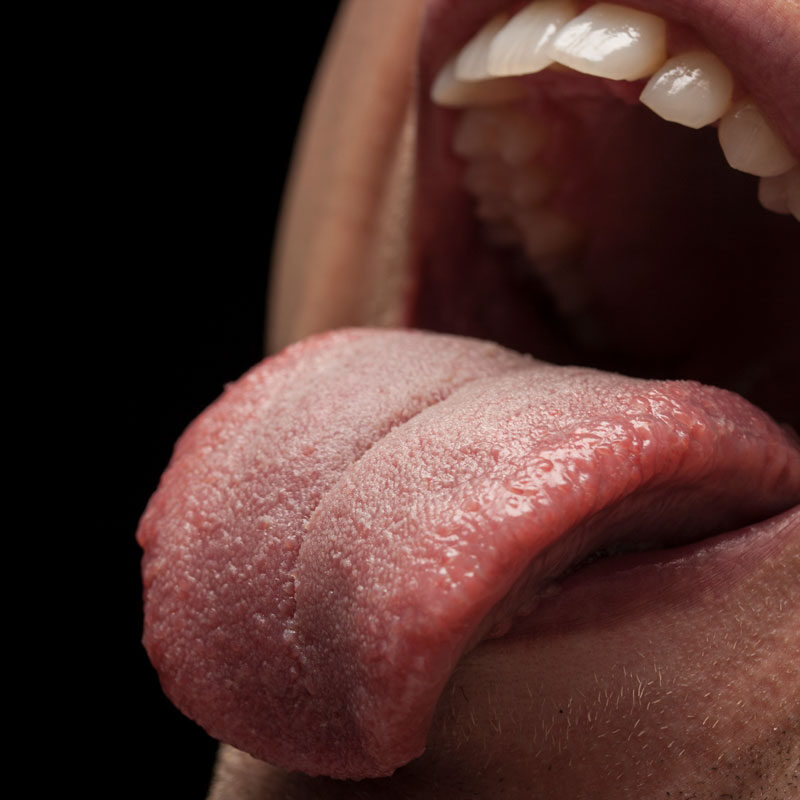 La lengua covid