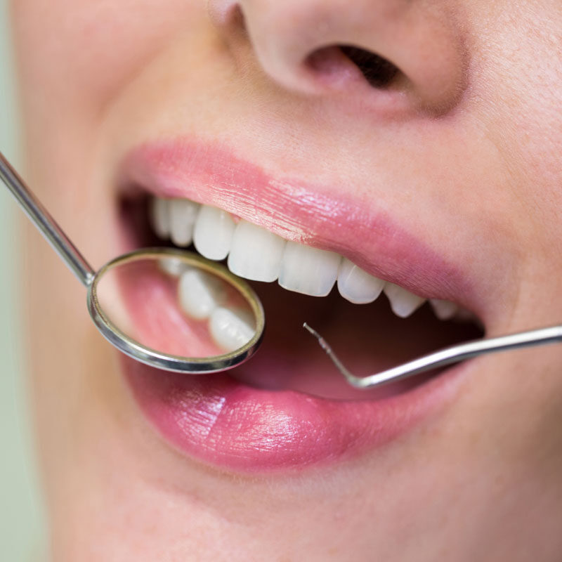 Razones por las que hay que ir al dentista