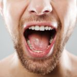 6 Pautas para prevenir el cáncer oral