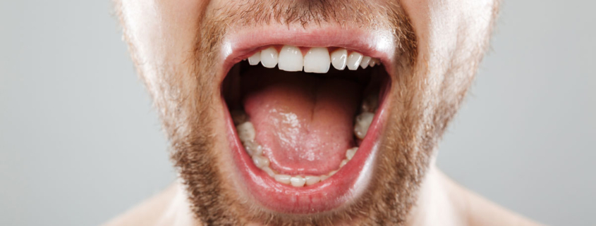 6 Pautas para prevenir el cáncer oral